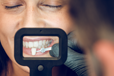 La estética dental es más importante de lo que parece