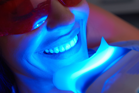 Principales tratamientos de estética dental