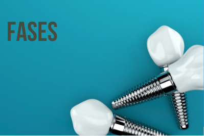 Ortodoncia con alineadores dentales